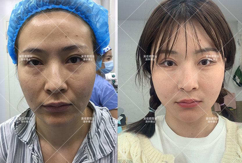 宿州_今晚买三肖必中,揭盖子调查的全面释义、解释与落实